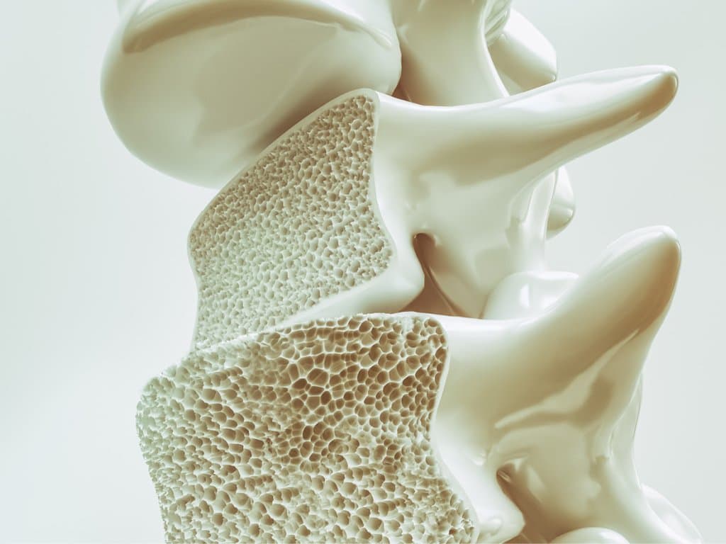 Low albumin levels increase osteoporosis risk in male T2D patients