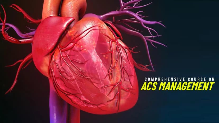 Acute COVID19 CV syndromes: An Introduction