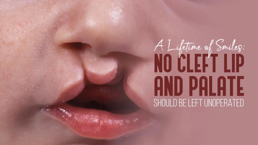 Rhinoplasty and Orthognathic Surgery