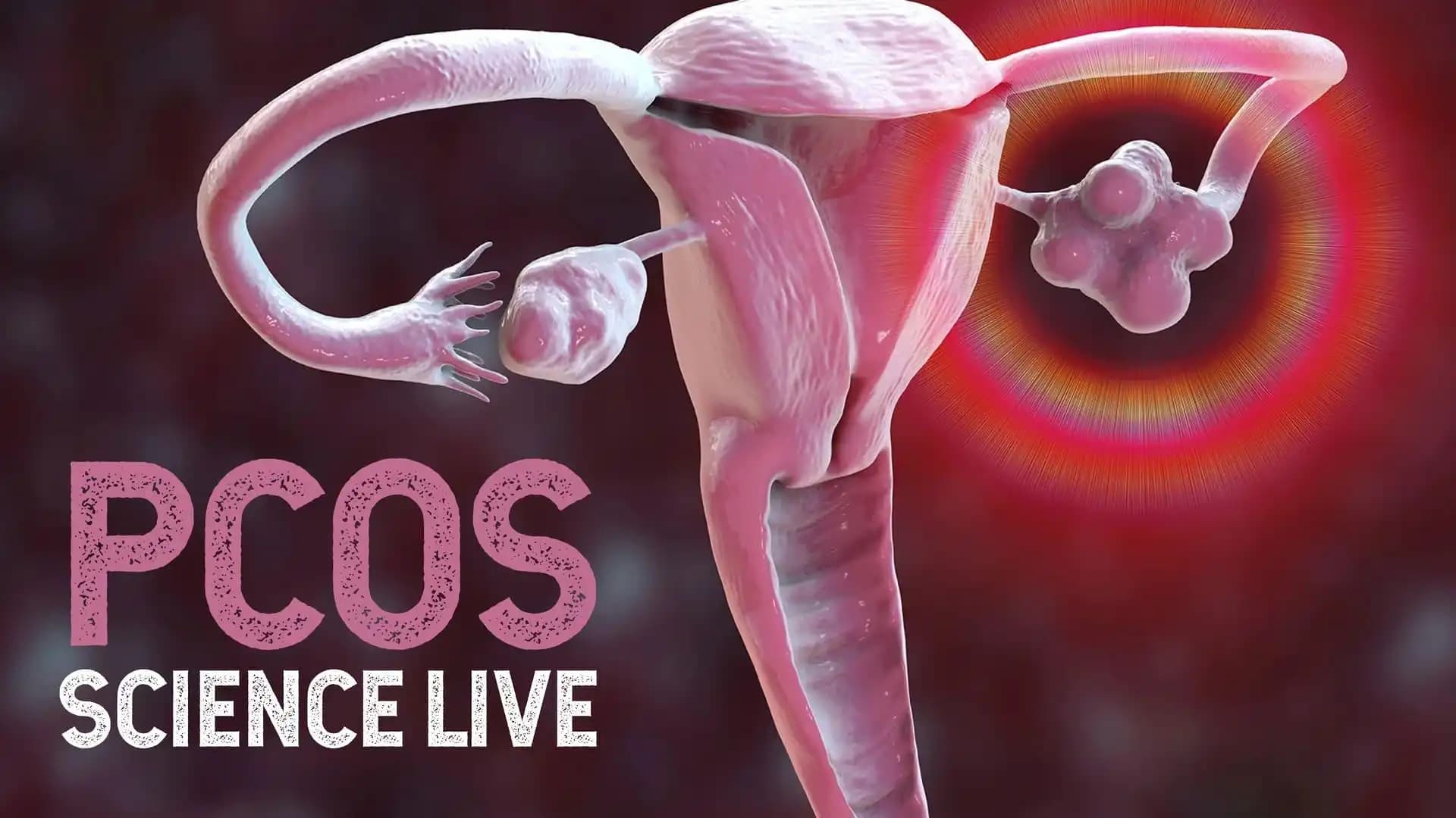 PCOS Science Live