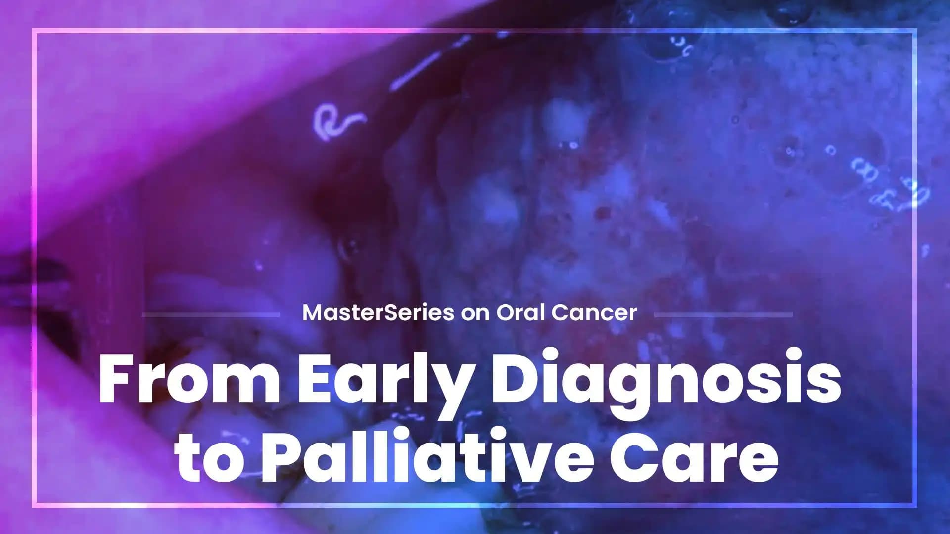 MasterSeries on Oral Cancer - From Early Diagnosis to Palliative Care