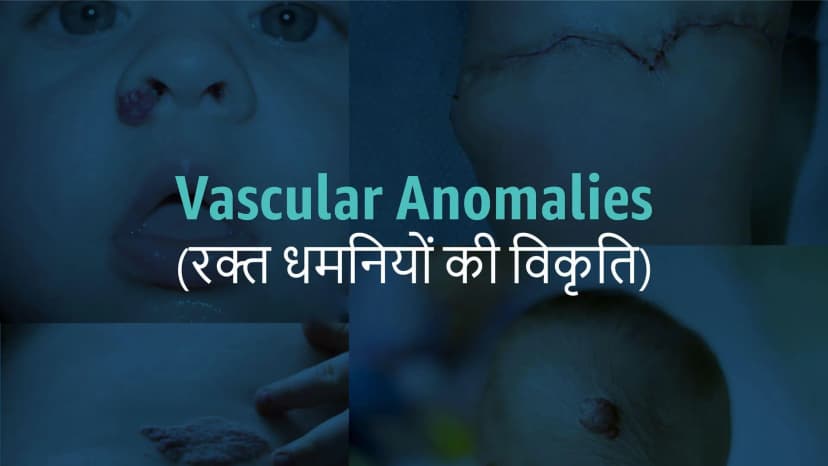 Vascular Anomalies: Patient counselling and Medical Insurance coverage