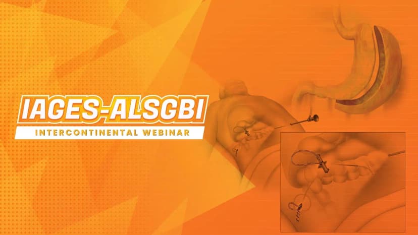 Laparoscopic Panproctocolectomy and Ileal J Pouch Anal Anastomosis Procedure