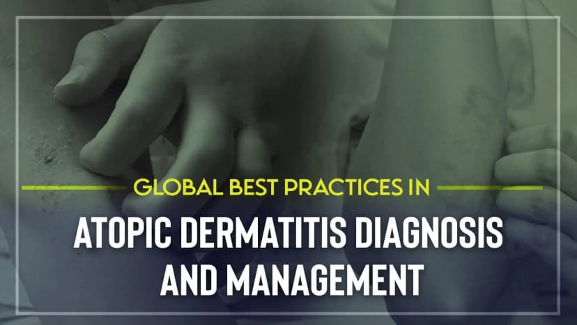 Atopic Dermatitis, New Topical Therapy