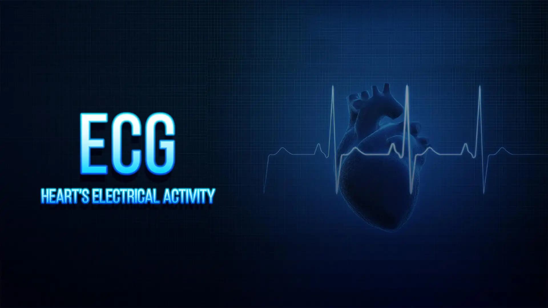 ECG- Heart's Electrical Activity