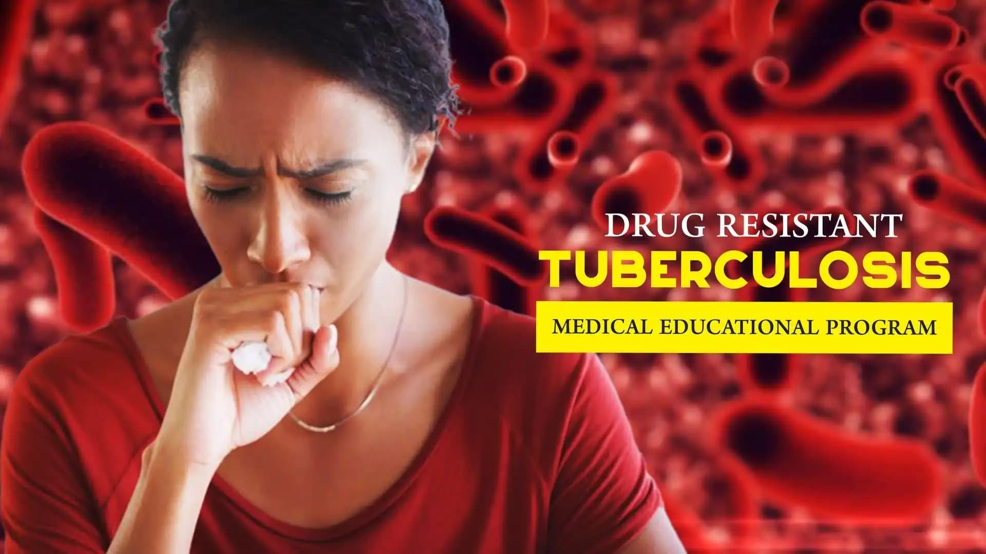 Drug Resistant TB
