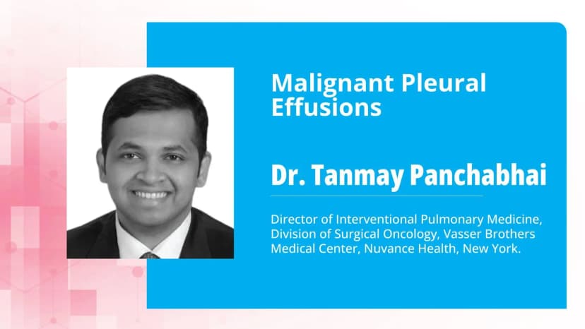 Malignant Pleural Effusions