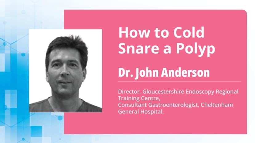  Step-by-Step Guide to Cold Snaring Polyps