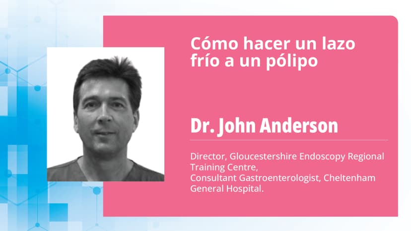 Parte 2: Guía detallada para hacer lazos frío a pólipos