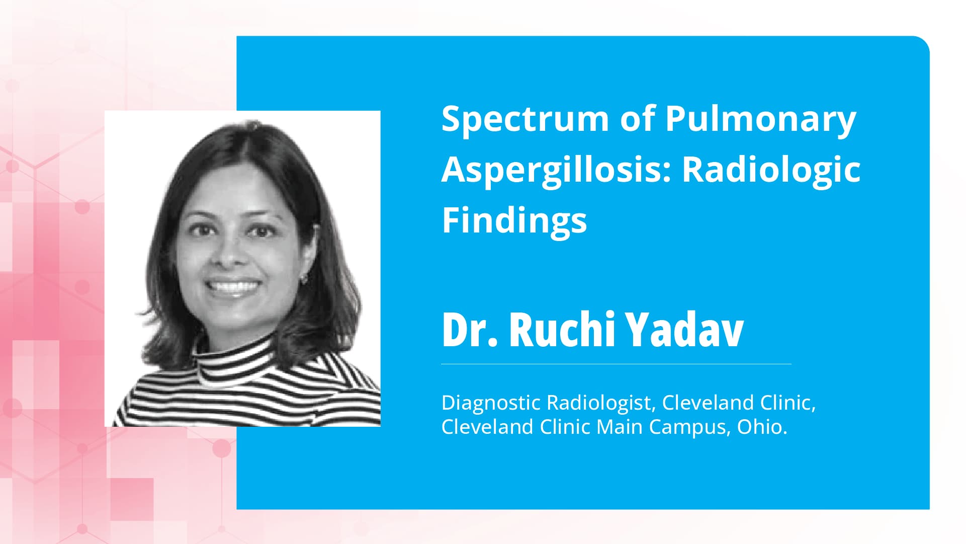 Spectrum of Pulmonary Aspergillosis: Radiologic Findings