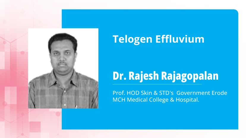 Telogen Effluvium