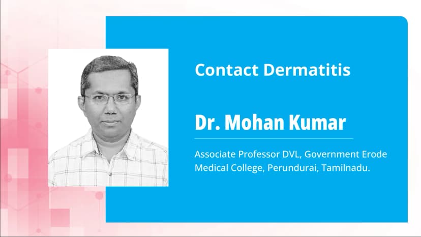 Part 2: Contact Dermatitis: Clinical Approach and Management