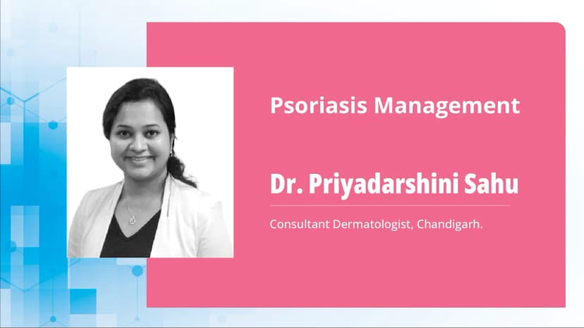 Psoriasis Management