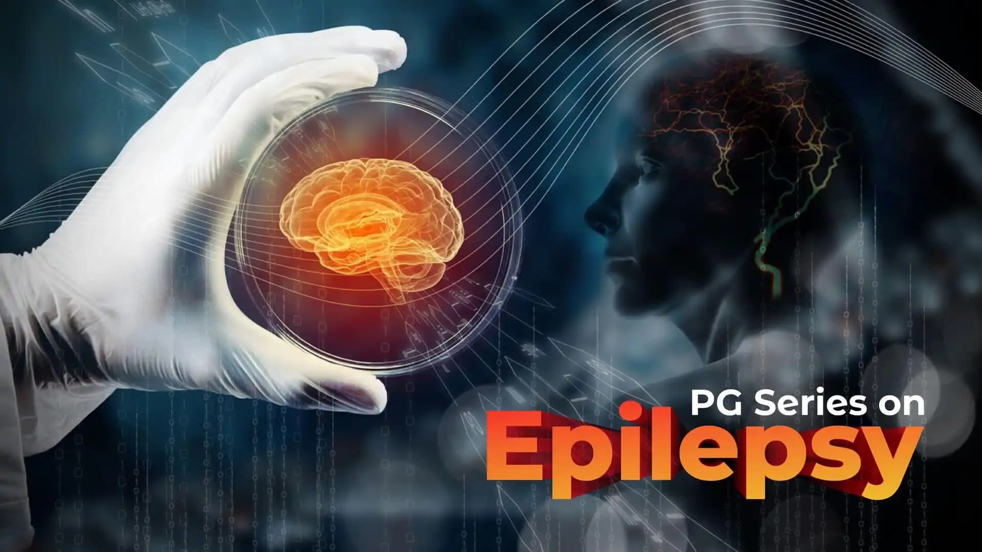 PG Series on Epilepsy