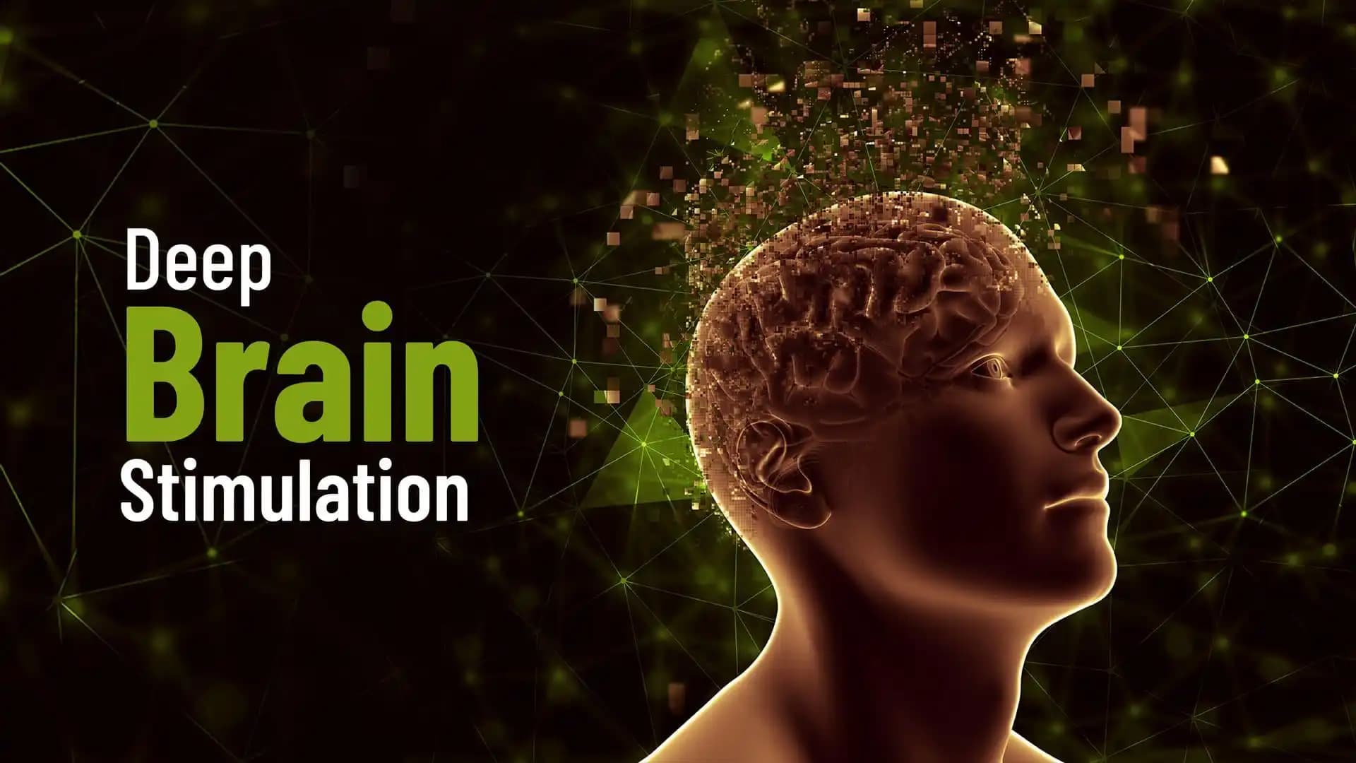 Deep Brain Stimulation