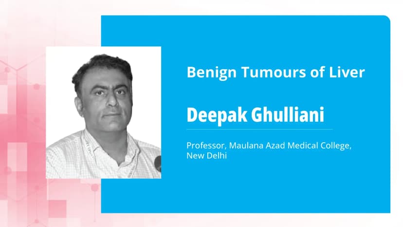 Benign Tumours of Liver