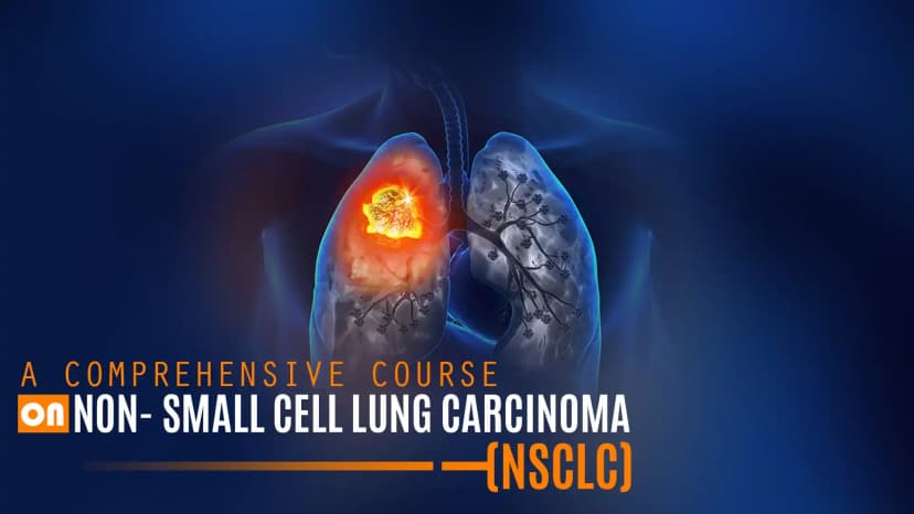 NSCLC- Approved 2nd line Therapy and NCCN  Recommendations