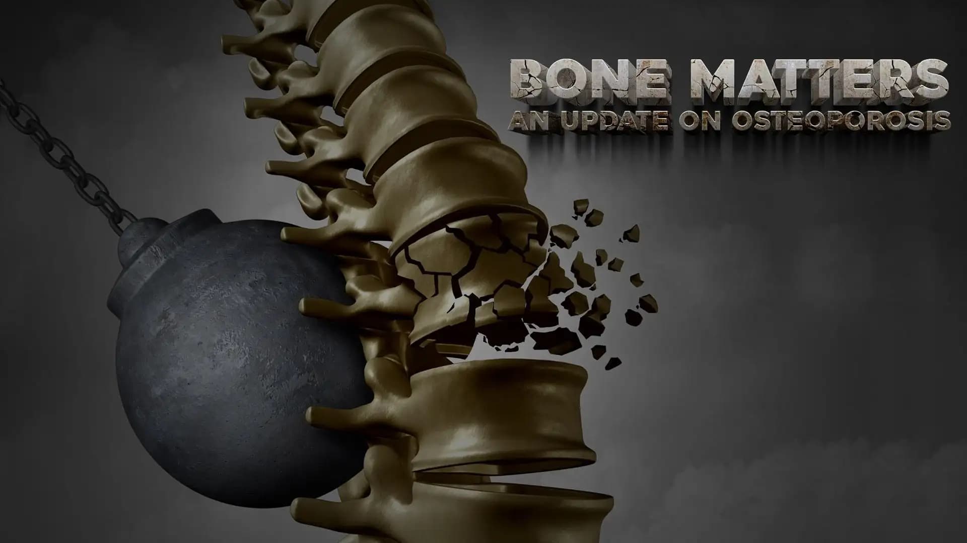 Bone Matters : An Update on Osteoporosis