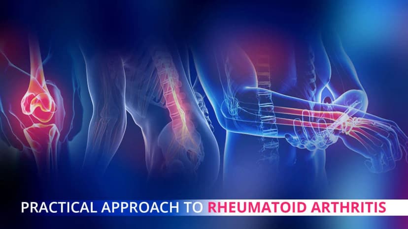 Etiology, Environmental Triggers and Animal Model of Rheumatoid Arthritis