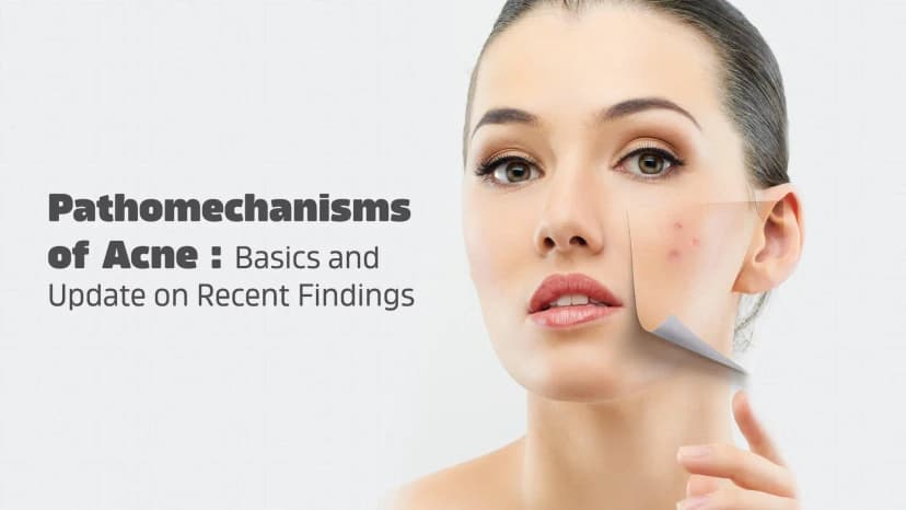 Pathomechanisms of Acne : Basics and Update on Recent Findings