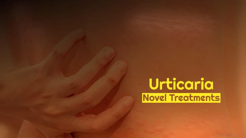 Urticaria Novel Treatments