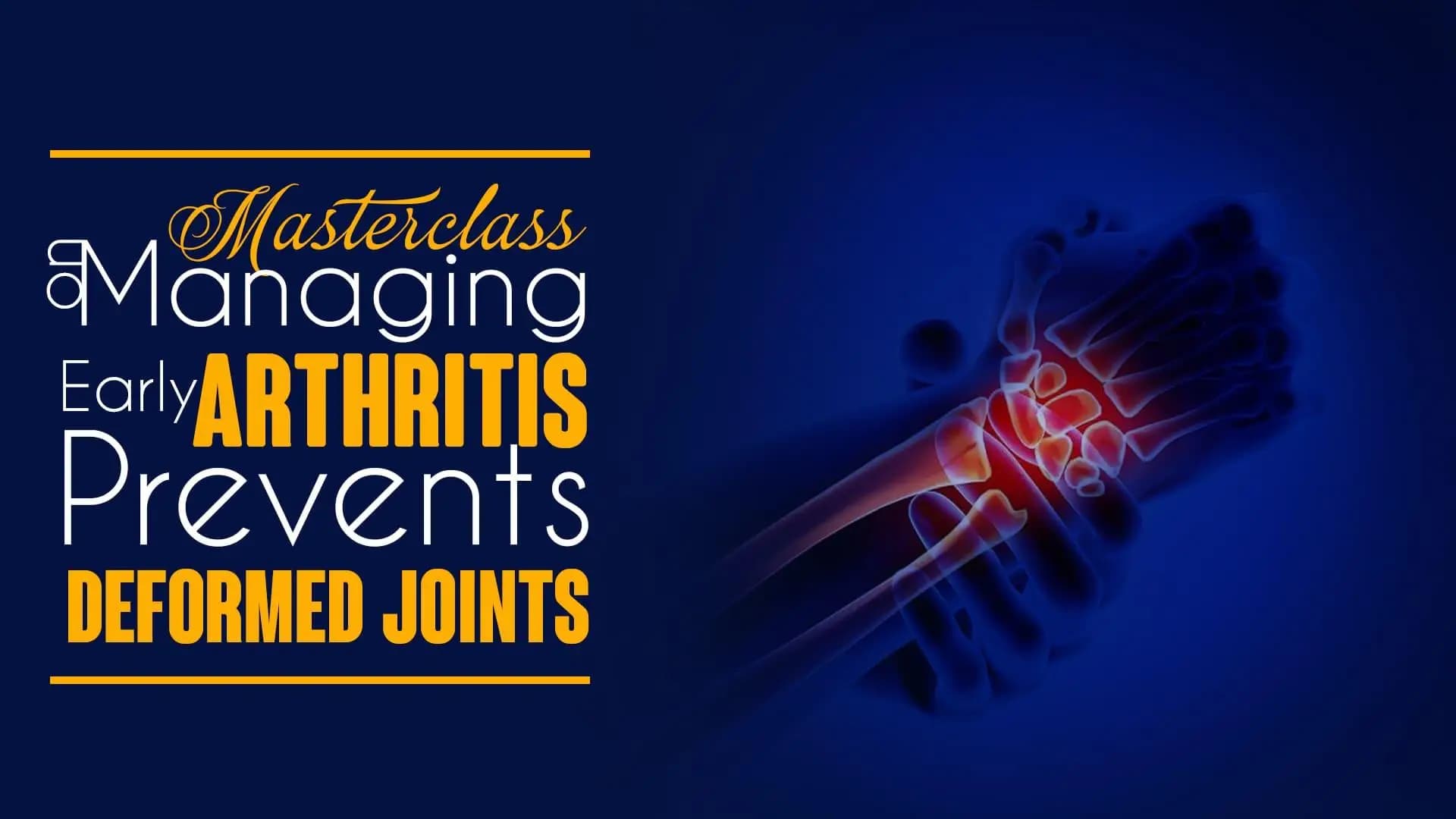 Masterclass on Managing Early Arthritis Prevents Deformed Joints