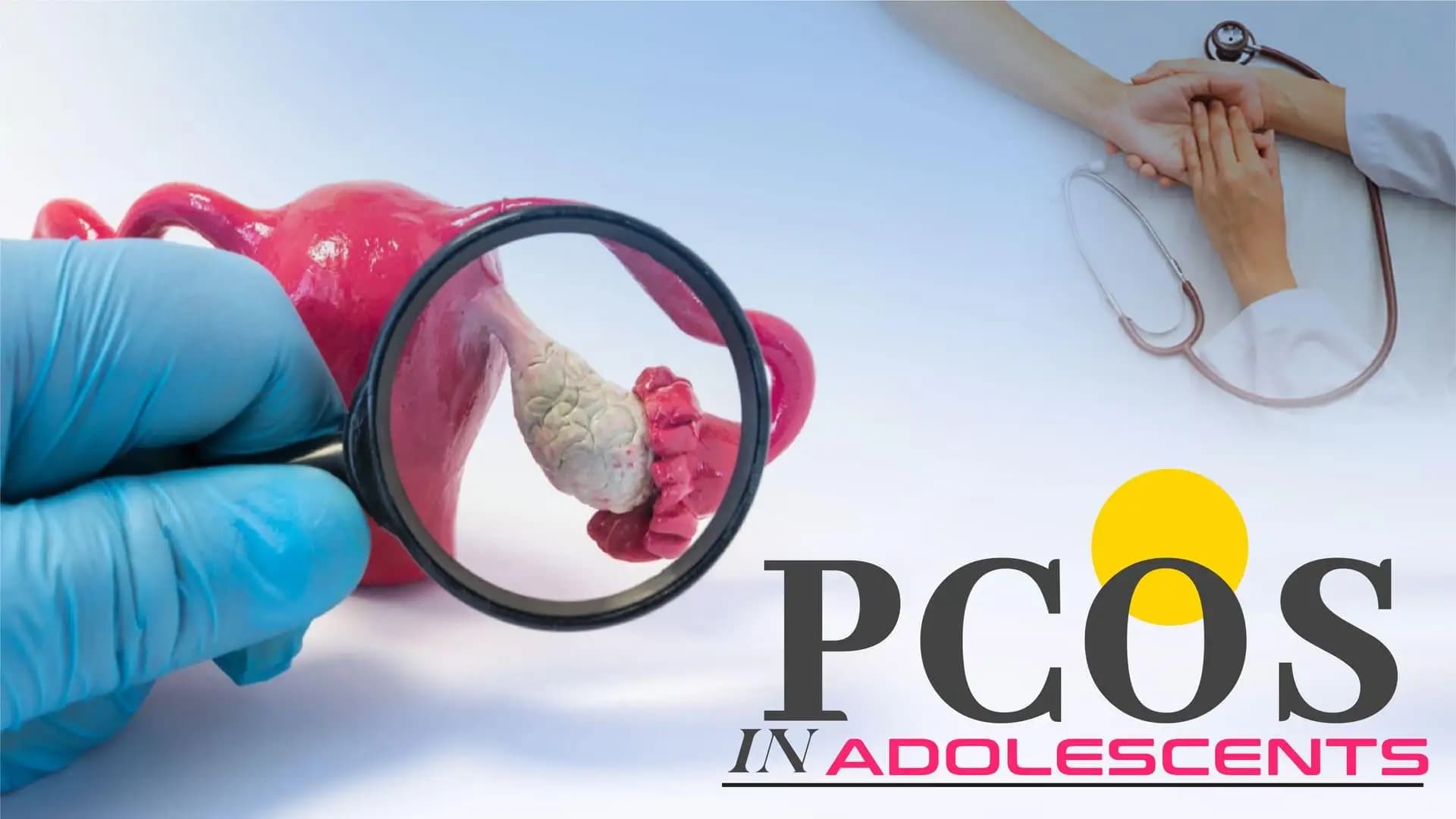 PCOS in Adolescents