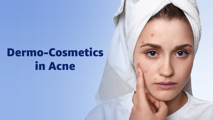 Dermo - Cosmetics in Acne