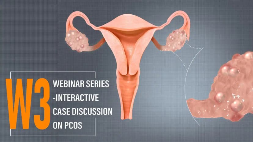 PCOS & OHSS- How Do We Prevent and Manage it?