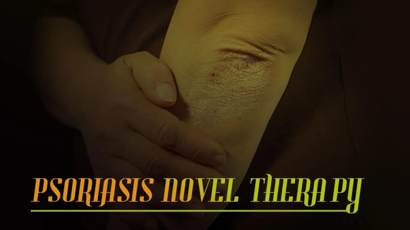 Psoriasis Novel Therapy
