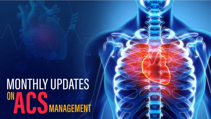 Summary: ACS management
