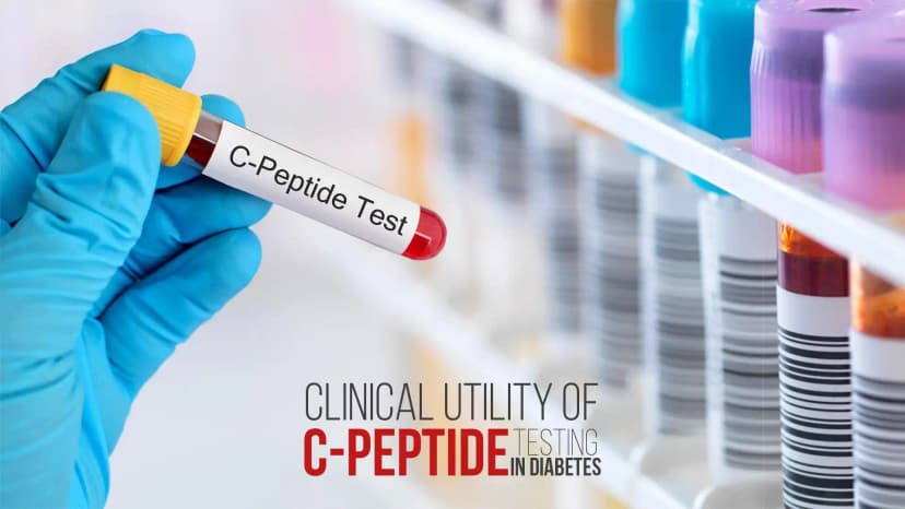Clinical Utility of C-Peptide Testing in Diabetes