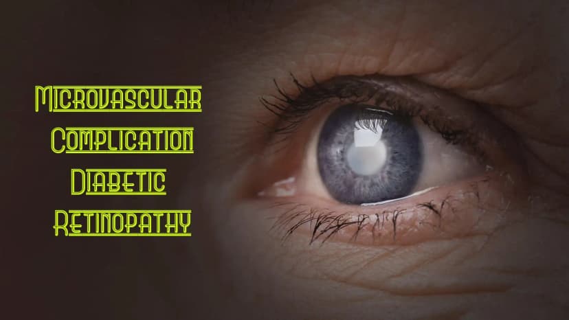 Microvascular Complication- Diabetic Retinopathy