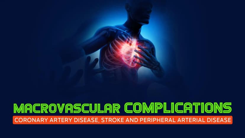 Macrovascular Complication: Coronary Artery Disease, Stroke and Peripheral Arterial Disease