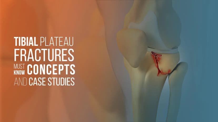 Tibial Plateau Fractures : Must Know Concepts and Case Studies