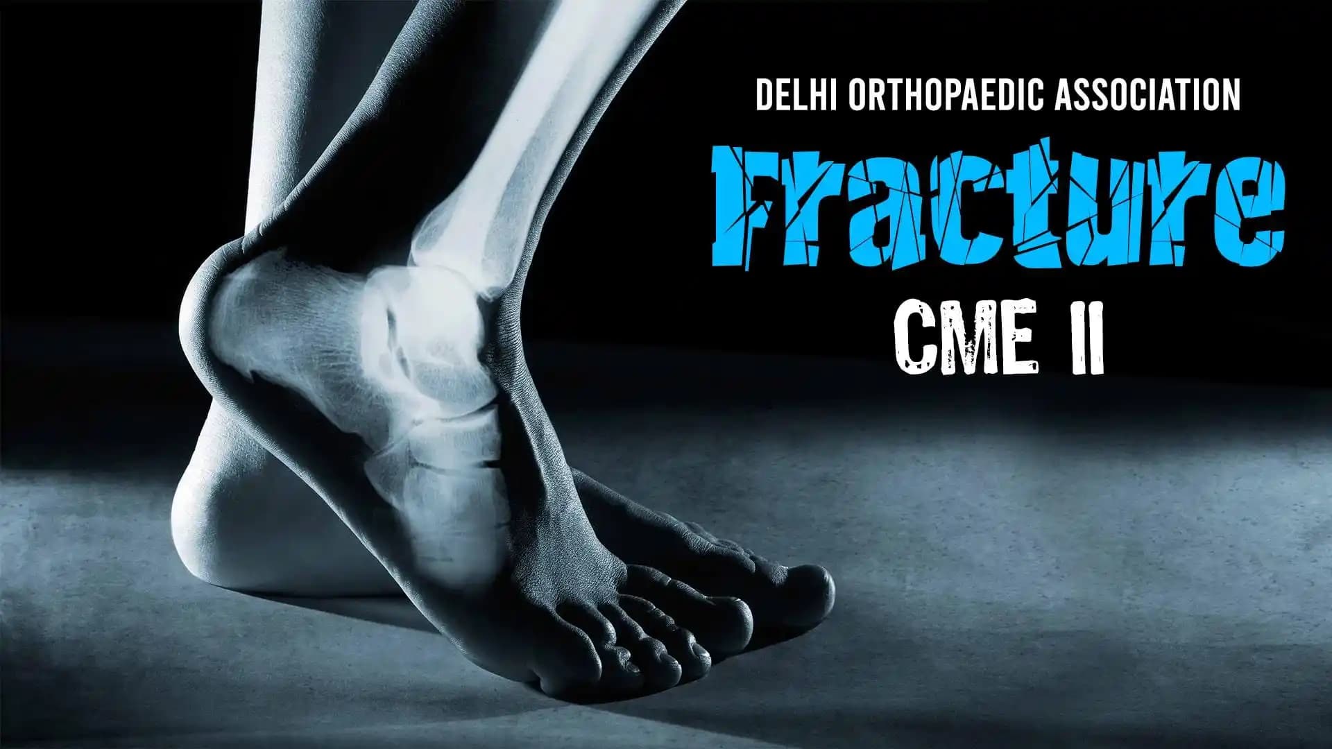 Delhi Orthopaedic Association - Fracture CME II