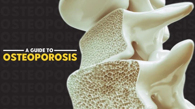 Diagnosing Osteoporosis in Young Women