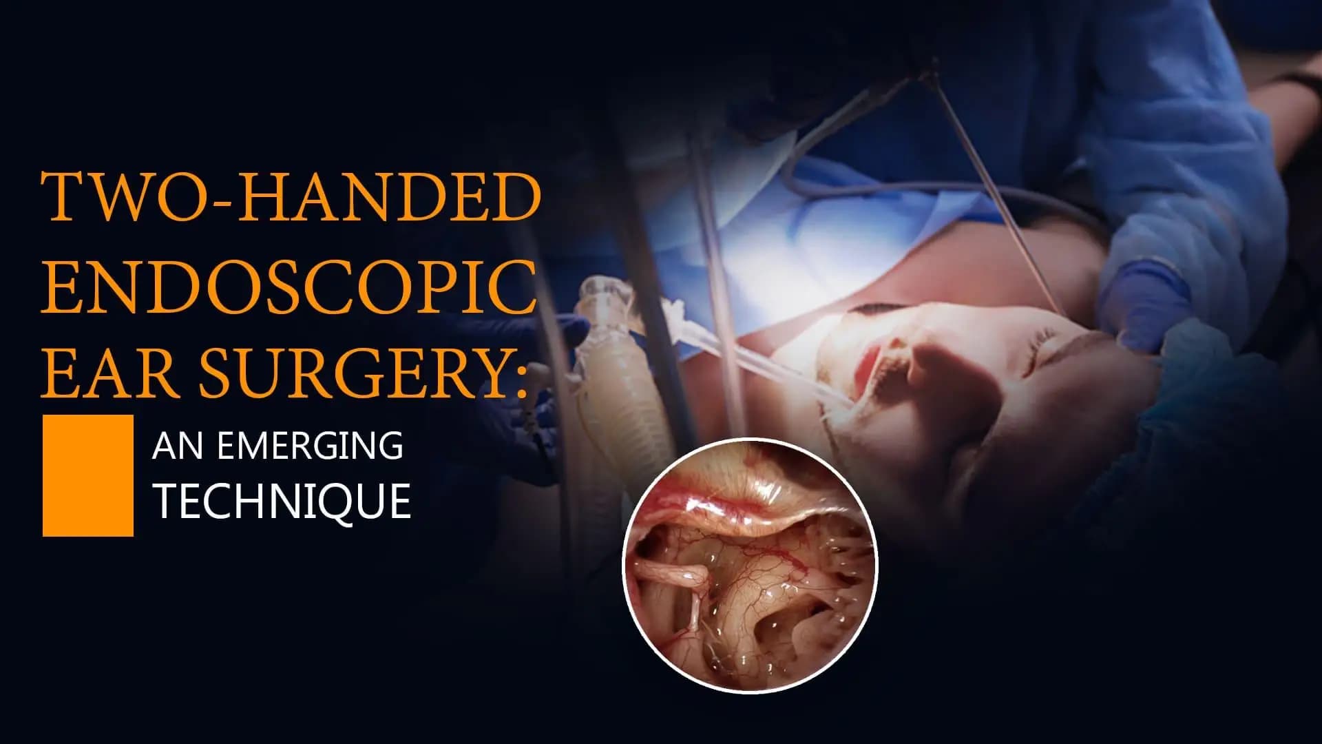 Two-Handed Endoscopic Ear Surgery: An Emerging Technique