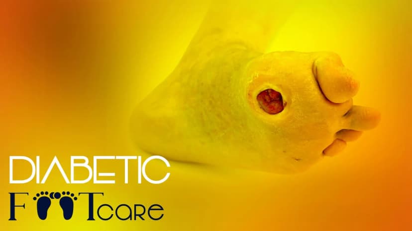 Diabetic Foot Care