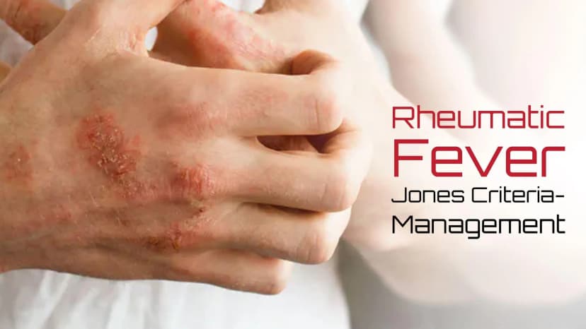 Rheumatic Fever-Jones Criteria-Management