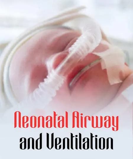 Neonatal Airway and Ventilation