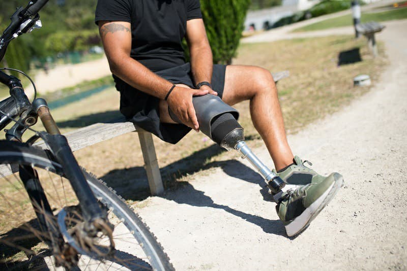 High prevalence of phantom limb pain post-amputation in African population