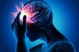 Migraine's impact on functioning revealed: Study provides patient insights