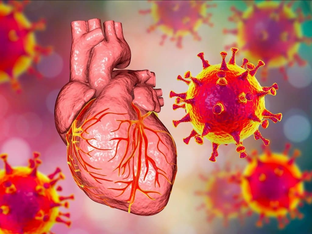 Impact of COVID-19 on care for AMI patients