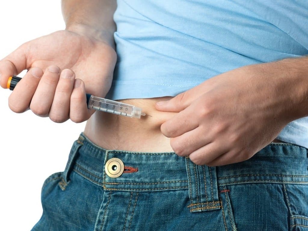 AF Risk in Type 1 Diabetes: Incidence and Cardiometabolic Predictors