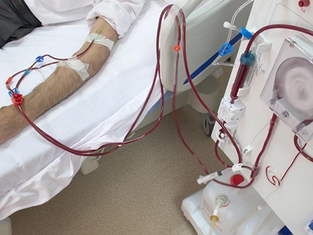 TyG index predicts heart failure in hemodialysis patients