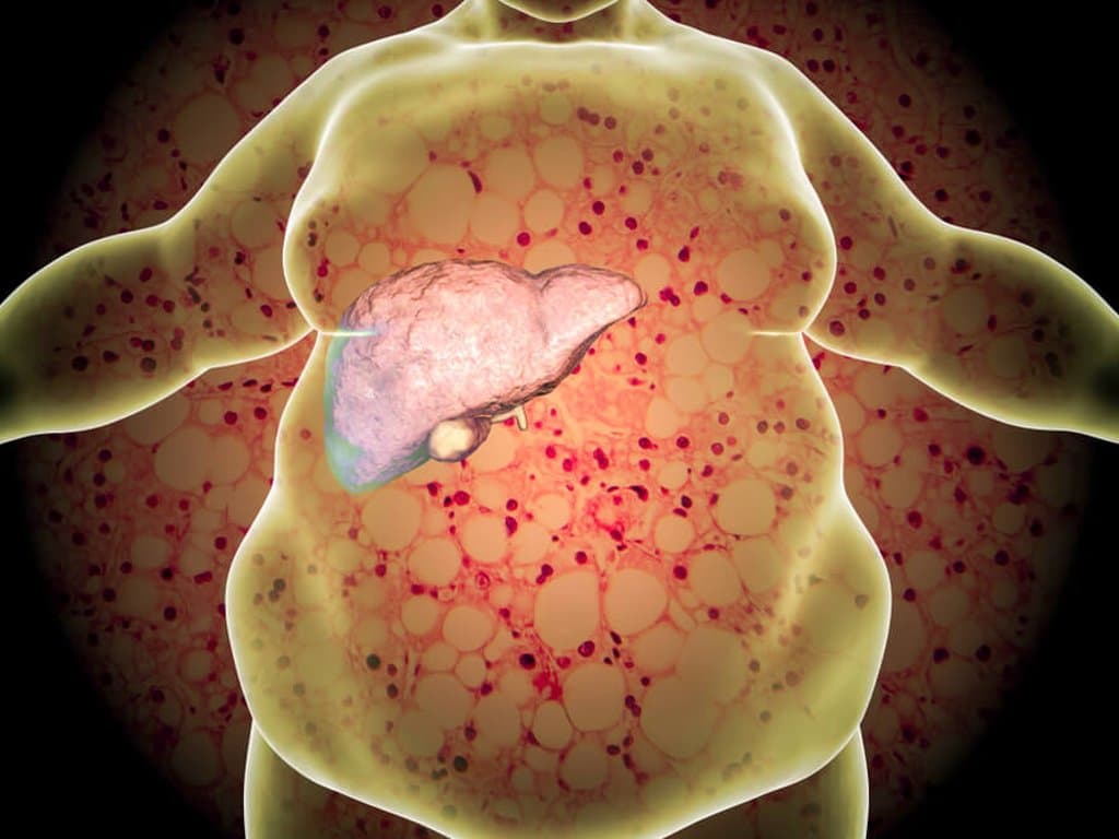 Body roundness index as a predictor of NAFLD