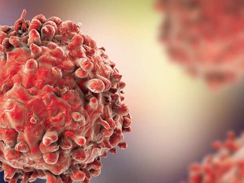 Microvascular Complications in T2D: No Link to Cancer Risk or Mortality