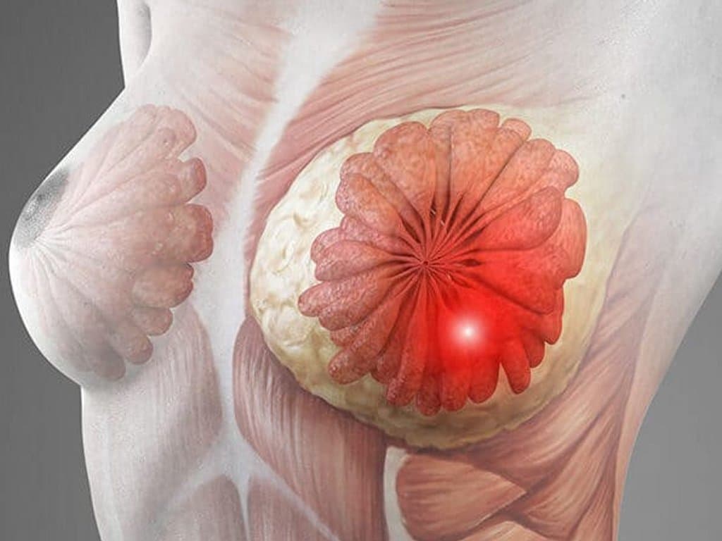 Risk factors and outcomes in synchronous breast–thyroid cancers