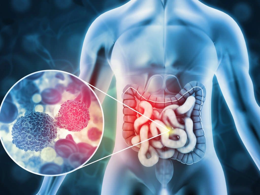 eGFR as a predictor of recurrence and prognosis in colorectal cancer